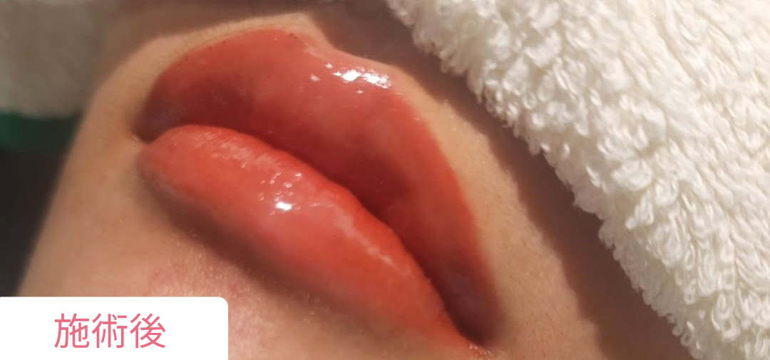 施術後