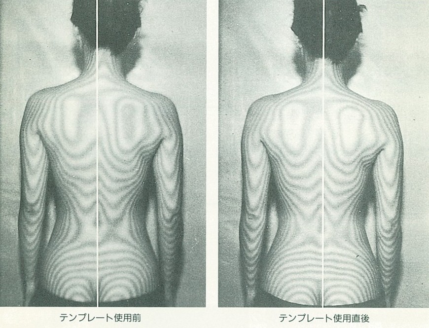 テンプレート使用前後の姿勢比較